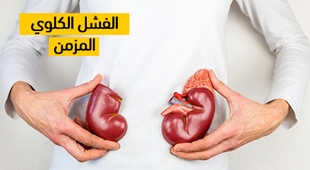 Magazine الفشل الكلوي المزمن