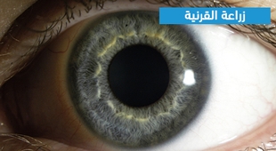 Magazine زراعة القرنية