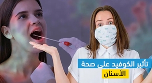 Makaleler تأثير الكوفيد على صحة الأسنان