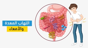 المجلة الطبية التهاب المعدة والأمعاء