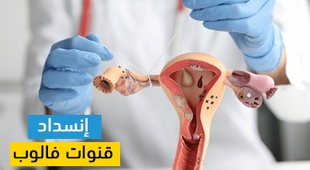 Magazine إنسداد قنوات فالوب