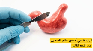 Magazine الجراحة هي أحسن علاج للسكري من النوع الثاني