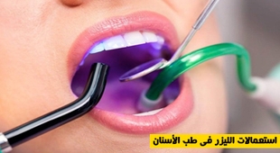 Magazine استعمالات الليزر في طب الأسنان