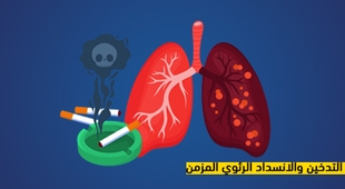 Magazine التدخين والانسداد الرئوي المزمن
