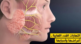 Magazine التهابات الغدد اللعابية : أعراضها وأسبابها