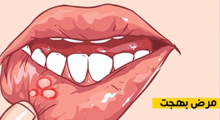 Magazine مرض بهجت