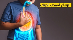 Magazine الارتجاع المعدي المريئي