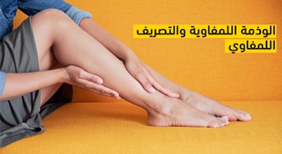 Magazine الوذمة اللمفاوية والتصريف اللمفوي