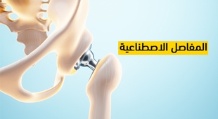 Makaleler المفاصل الاصطناعية