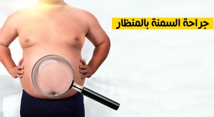 Magazine جراحة السمنة بالمنظار