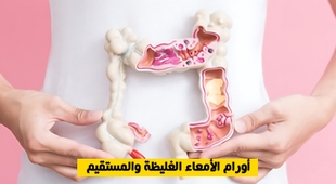 Magazine أورام الأمعاء الغليظة والمستقيم