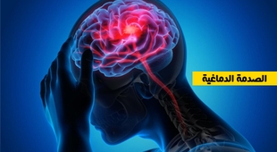 Magazine الصدمة الدماغية