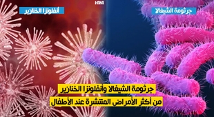 Magazine جرثومة الشيغالا وأنفلونزا الخنازير من أكثر الأمراض المنتشرة عند الأطفال