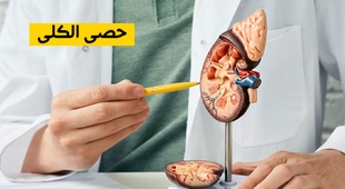 Magazine حصى الكلى