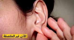 Magazine الأذن غير الملتصقة