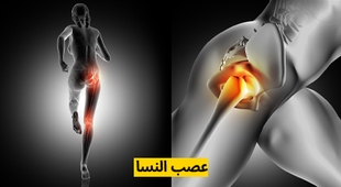 Magazine عصب النسا