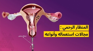 Magazine المنظار الرحمي : مجالات استعماله وأنواعه