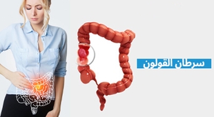 Magazine سرطان القولون