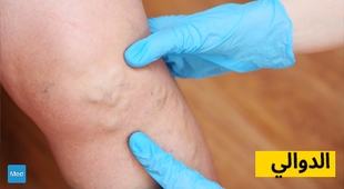 Magazine الدوالي