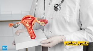 المجلة الطبية تكيس المبايض