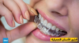 Magazine قشور الأسنان التجميلية