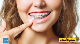 Magazine تقويم الأسنان