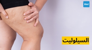 Makaleler السيلوليت