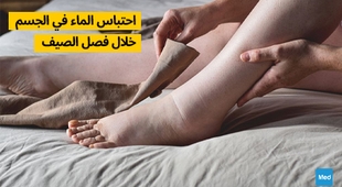 Magazine احتباس الماء في الجسم خلال فصل الصيف