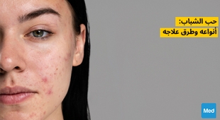 المجلة الطبية حب الشباب: أنواعه وطرق علاجه