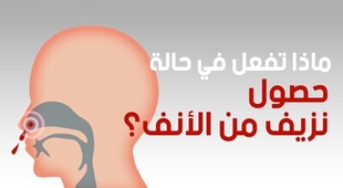 Magazine ماذا تفعل في حالة حصول نزيف من الأنف؟