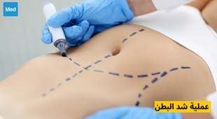 Magazine عملية شد البطن