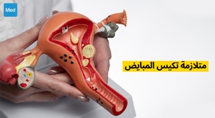 Makaleler متلازمة المبيض المتعدد الكيسات