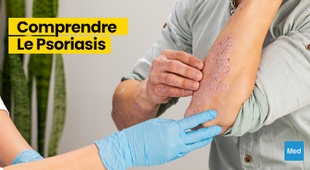 Magazine Comprendre le Psoriasis : Démystification d'une Maladie Courante