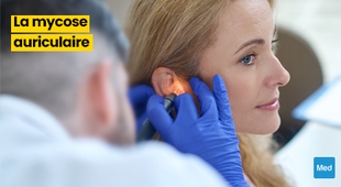 Magazine La Mycose Auriculaire de l'Oreille : Symptômes, Diagnostic et Traitement