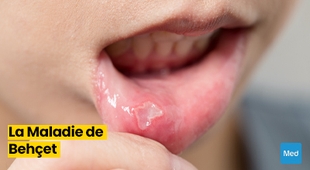 Magazine Comprendre la Maladie de Behçet : Symptômes, Diagnostic et Gestion