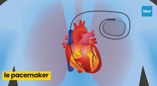 Magazine Qu'est-ce qu'un Pacemaker ?
