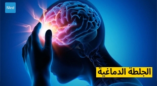 Magazine الجلطة الدماغية: التشخيص والعلاج والوقاية