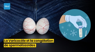 Makaleler La Varicocèle et la Congélation de Spermatozoïdes : Préservation de la Fertilité avant une Intervention