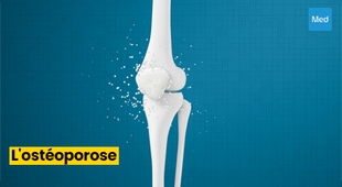 Magazine Comprendre et Prévenir l'Ostéoporose : Des Os Solides pour une Vie Saine