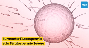 Makaleler Congélation de Sperme : L'Espoir pour Surmonter l'Azoospermie et la Tératospermie Sévère