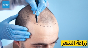 Magazine زراعة الشعر