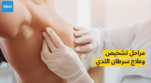 المجلة الطبية مراحل تشخيص وعلاج سرطان الثدي