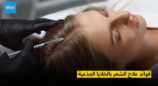 المجلة الطبية فوائد علاج الشعر بالخلايا الجذعية