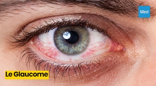 Magazine Comprendre le Glaucome : Enjeux, Symptômes et Prévention
