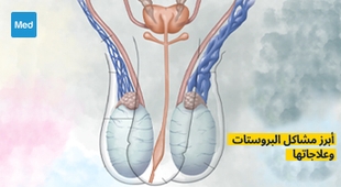 Magazine أبرز مشاكل البروستات وعلاجاتها