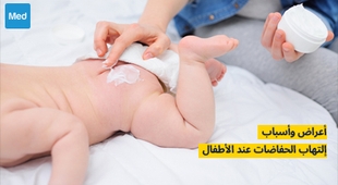 Magazine أعراض وأسباب التهاب الحفاظات عند الأطفال