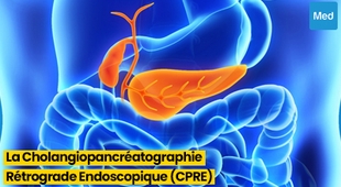 Magazine Tout ce que vous devez savoir sur la Cholangiopancréatographie Rétrograde Endoscopique (CPRE)