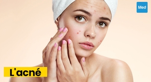 Makaleler Comprendre l'Acné