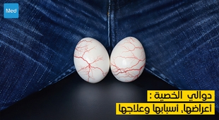 Makaleler دوالي الخصية : أعراضها، أسبابها وعلاجها