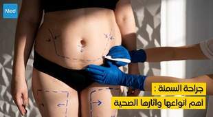 Magazine جراحة السمنة : أهم أنواعها وآثارها الصحية